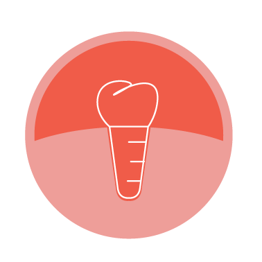 Implants treatments carried out at the Complete Dental Care