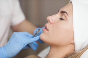 Hyaluronic acid Dermal Fillers carried out at the Complete Dental Care