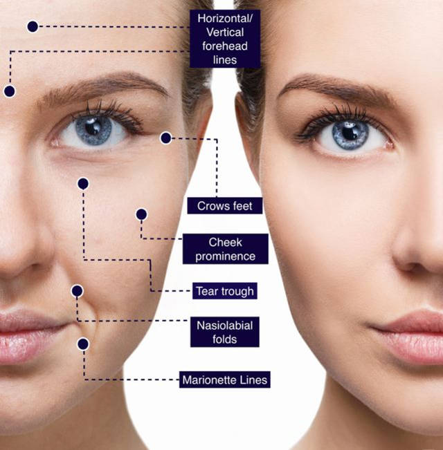 The process of skin aging